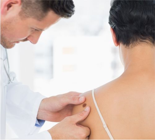 Centro Médico Medex | Dermatología