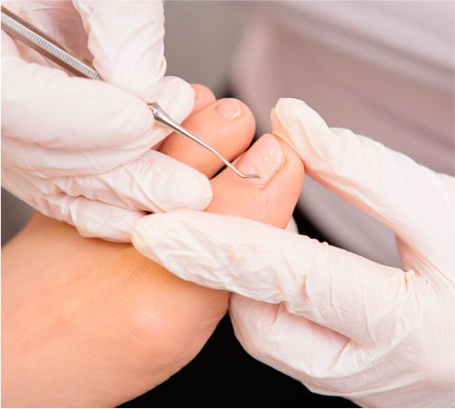 Centro Médico Medex | Podología