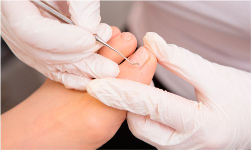 Centro Médico Medex | Podología